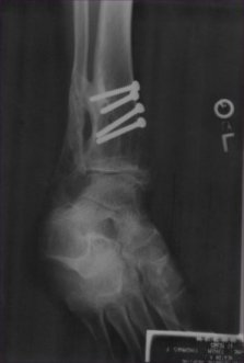 leg.jpg (13480 bytes)